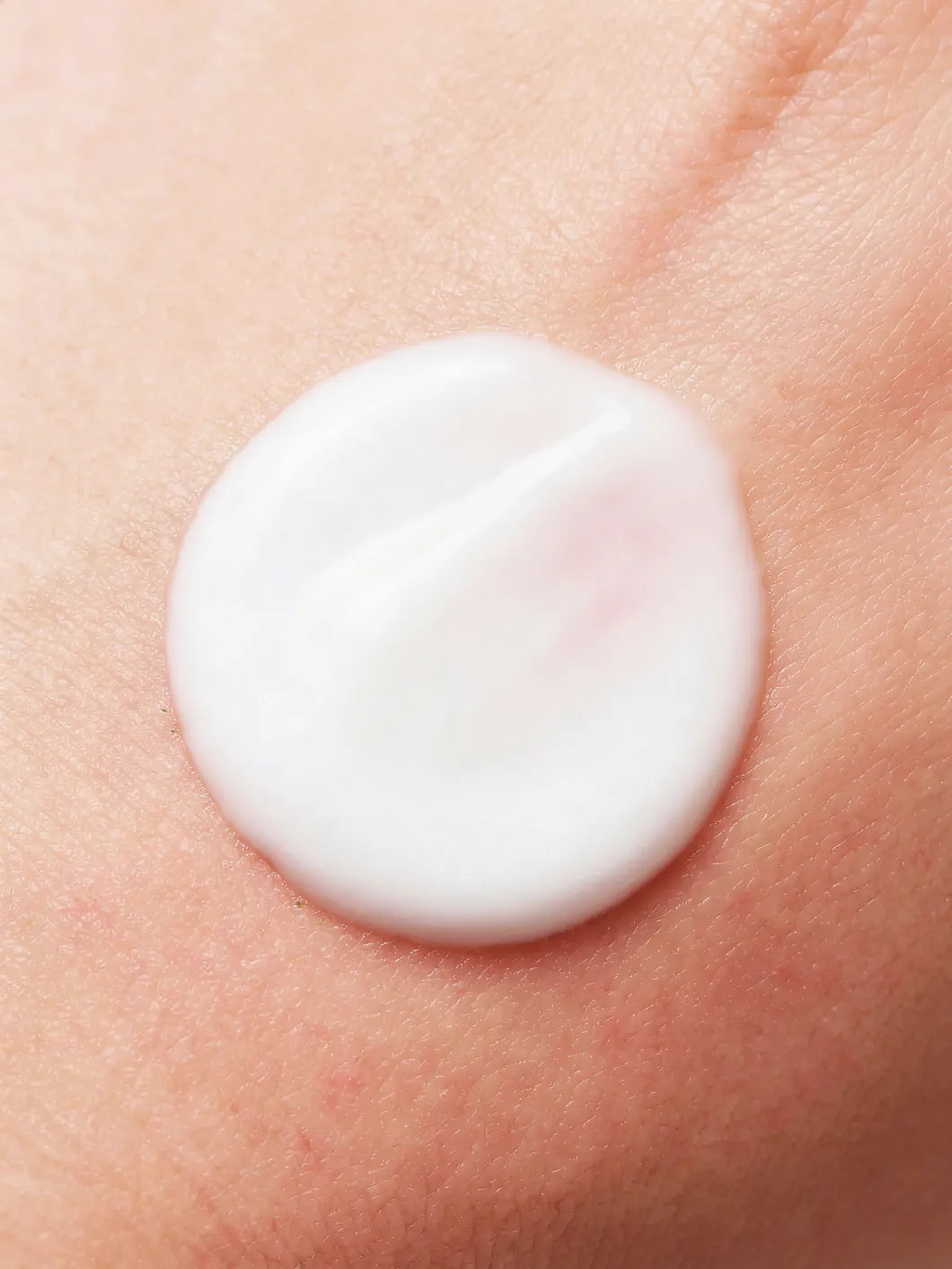 Yelf Spot Off Anti-Redness Cream – white fluid texture applied on slightly red skin in close-up