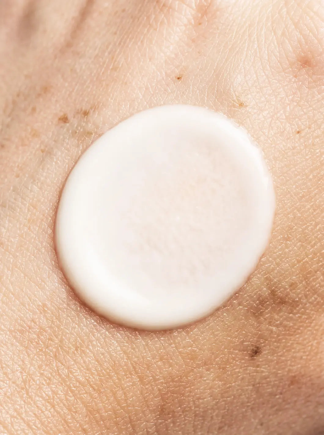 Yelf Spot Off Pigment Fix Serum – cream-colored fluid texture applied on skin with natural hyperpigmentation in close-up